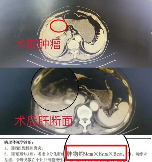 如何让高龄笔记本电脑焕发新生？有哪些有效方法？